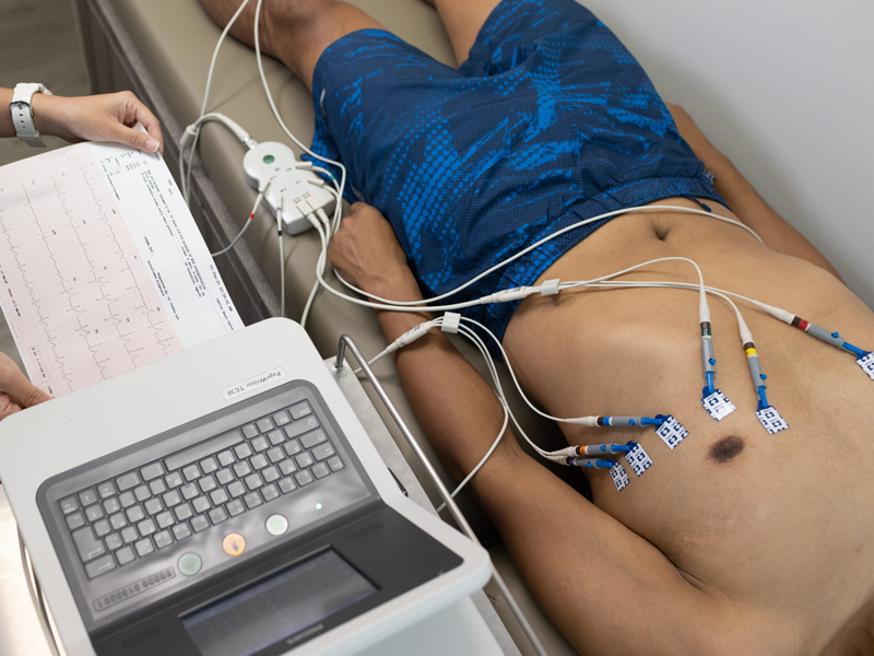ecg